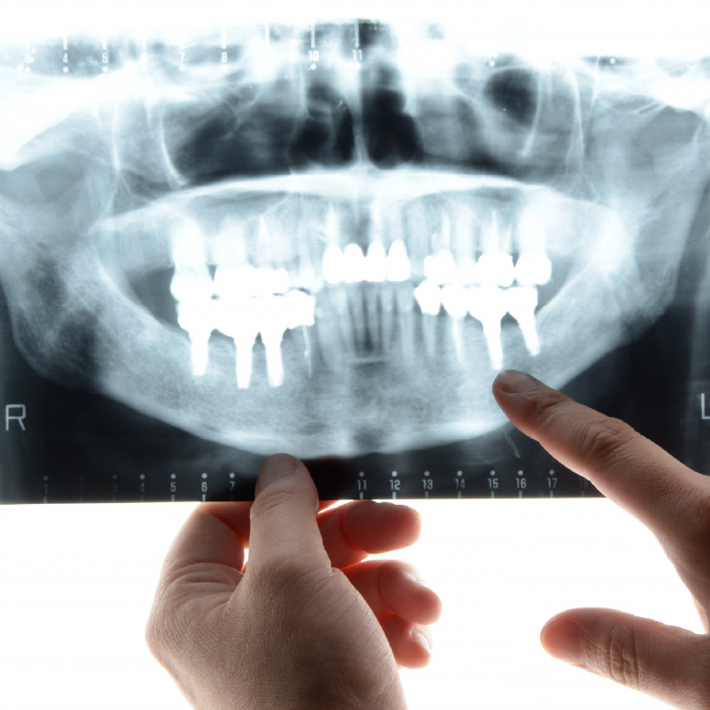 治療の適応性について