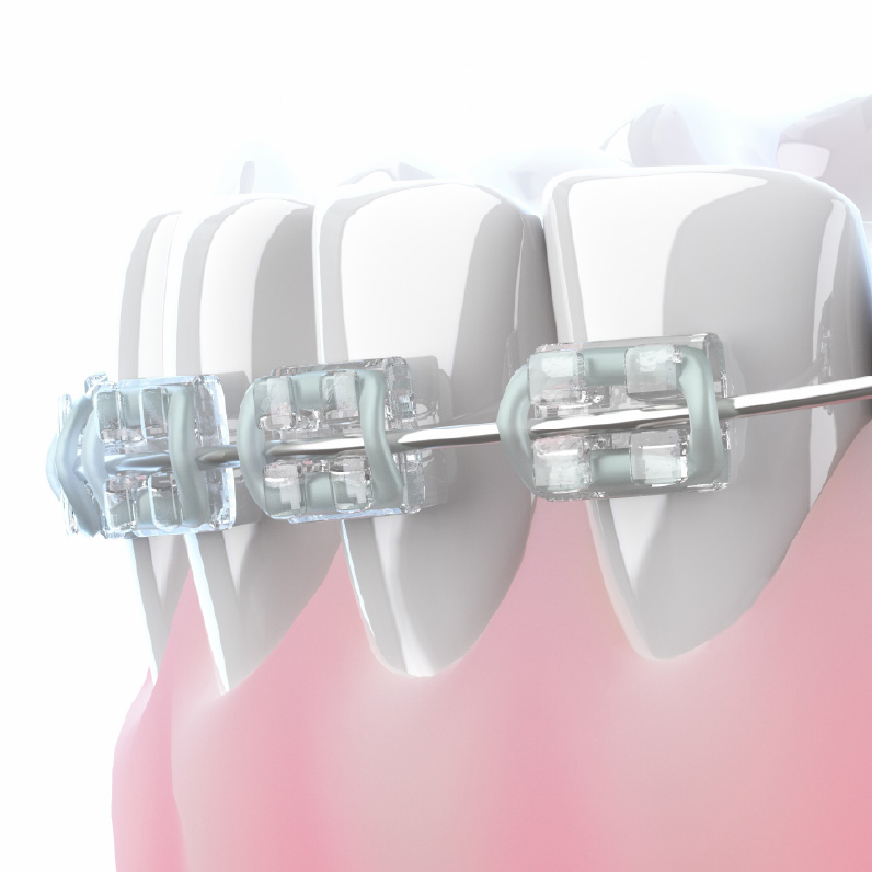 子どもから大人まで矯正治療の大切さ